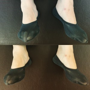 足首の整体、那覇市女性