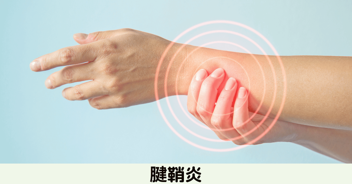 沖縄で腱鞘炎でお困りなら当院まで