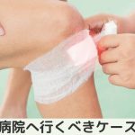 打撲後だんだん痛くなる！病院へ行くべきケースとは？